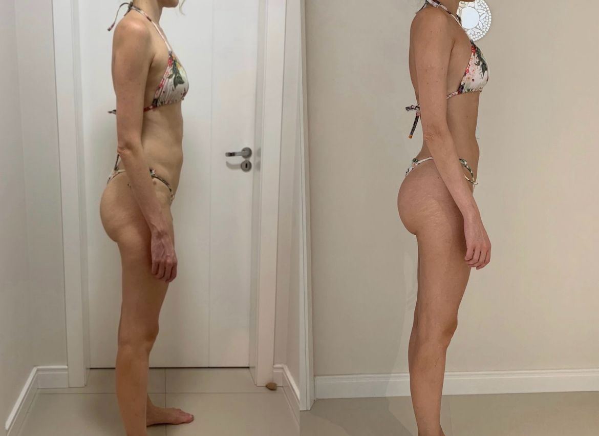 Evolução de aluna: antes e depois, vista lateral