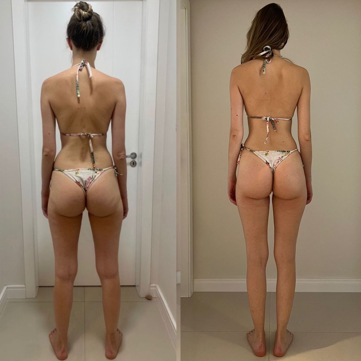 Evolução de aluna: antes e depois, vista posterior