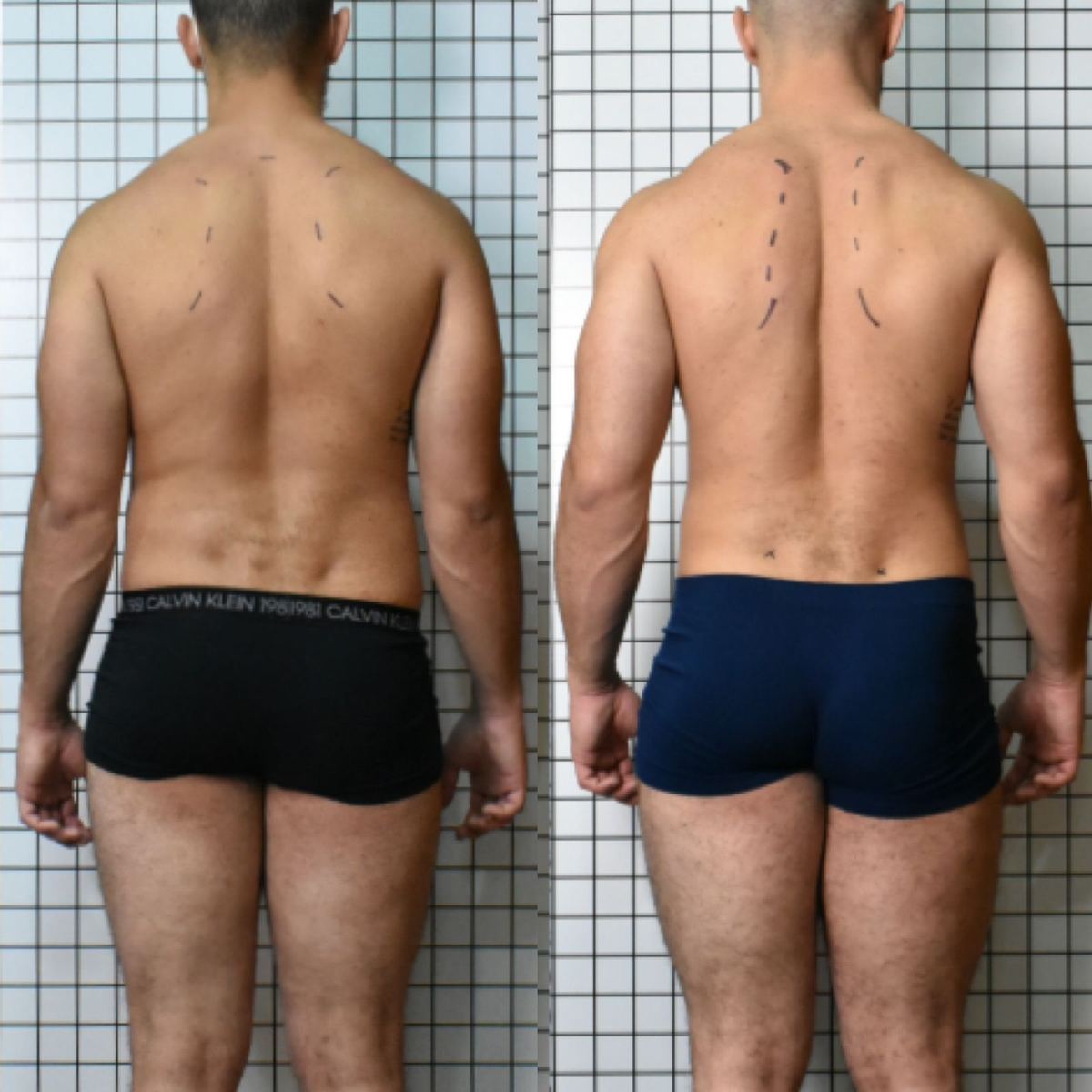 Evolução de aluno: antes e depois, vista posterior